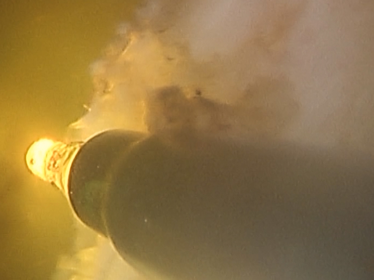 vaporizzazione della prostata con laser