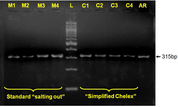 A Simple Chelex Protocol for DNA Extraction from Anopheles spp. | Protocol