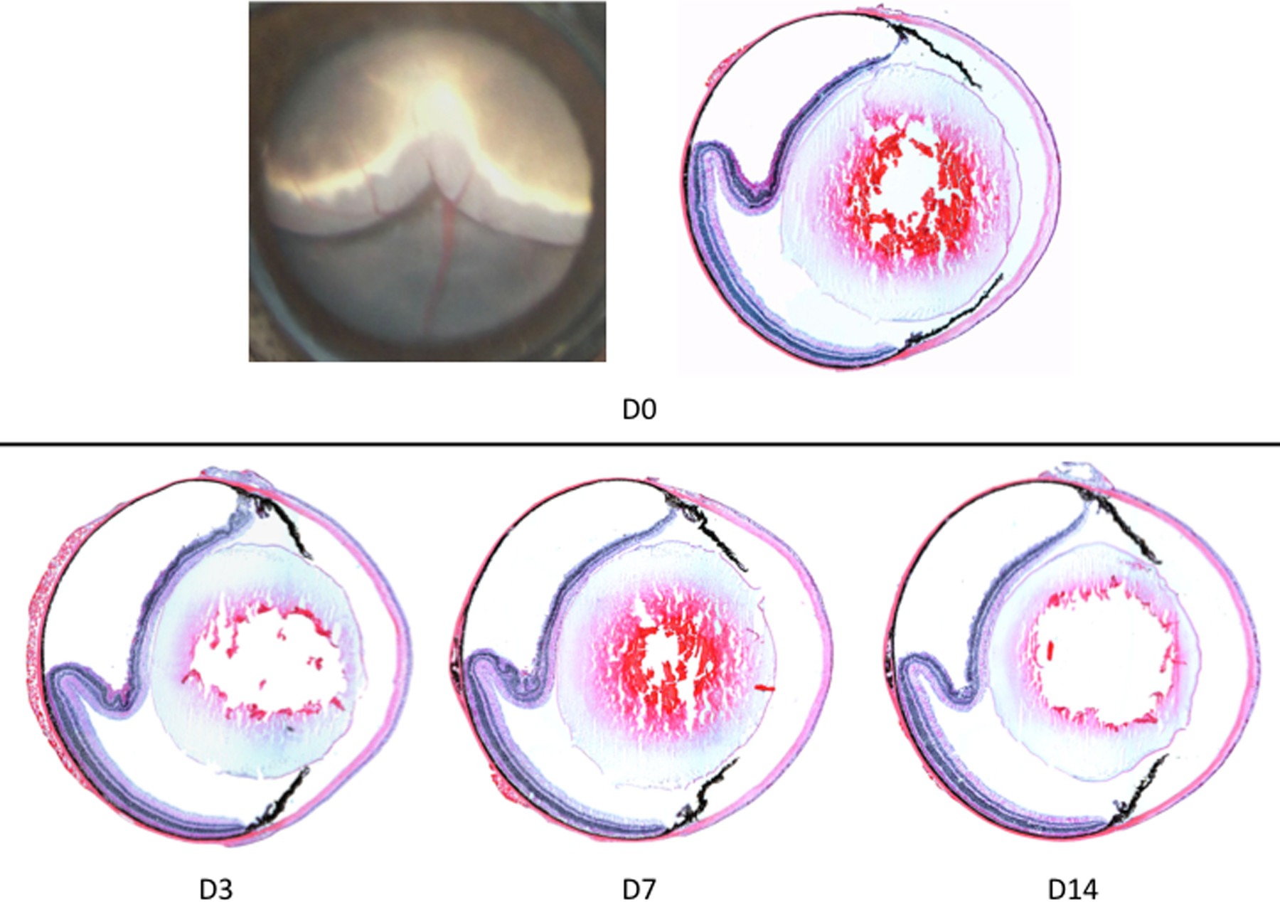 Retinal Detachment Model in Rodents by Subretinal Injection of Sodium