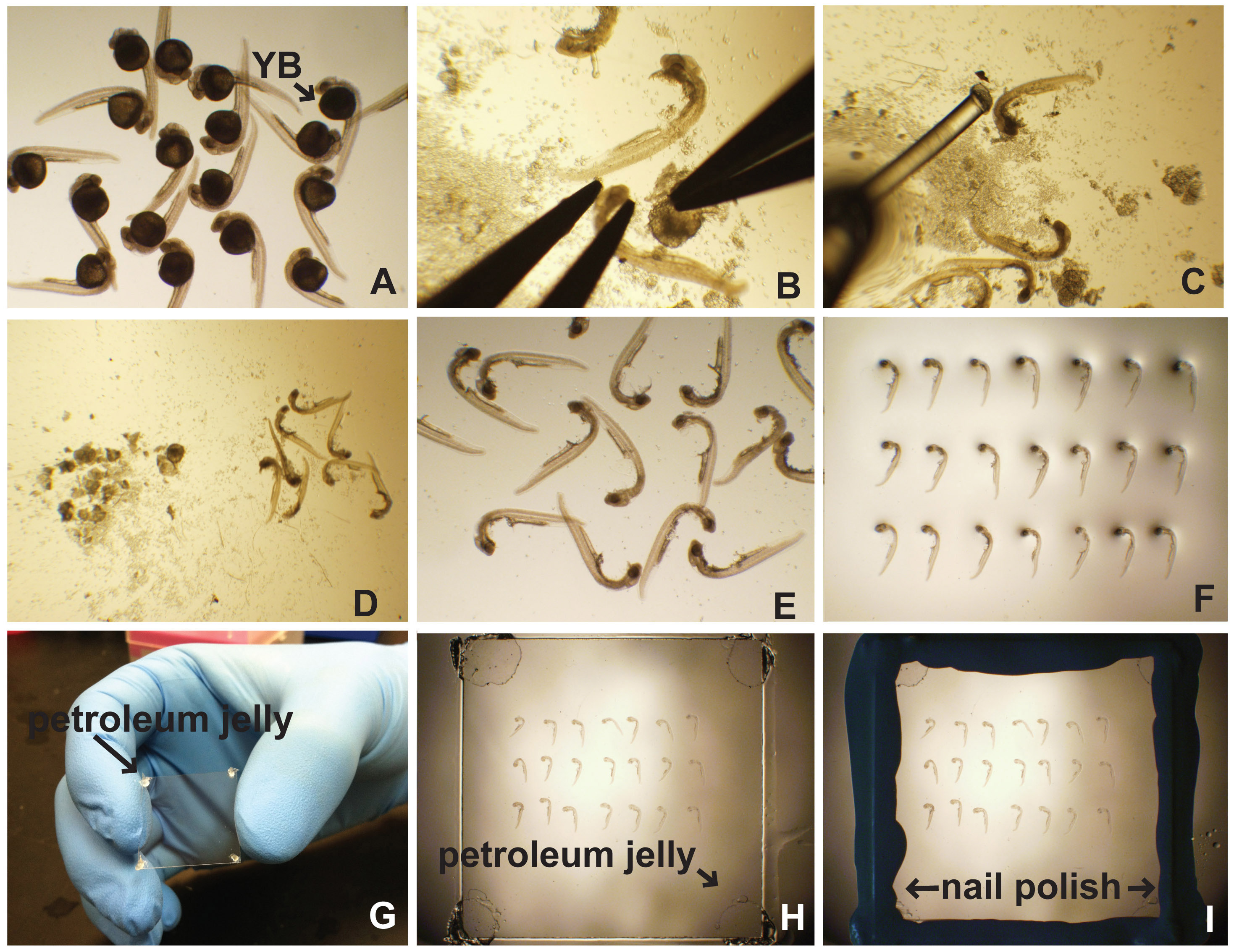 Dissection and Lateral Mounting of Zebrafish Embryos Analysis of