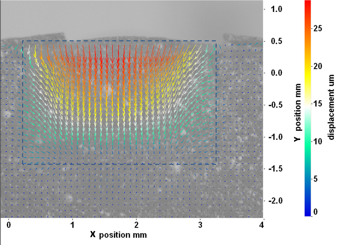Shrinkage of Dental Composite in Simulated Cavity Measured with Digital