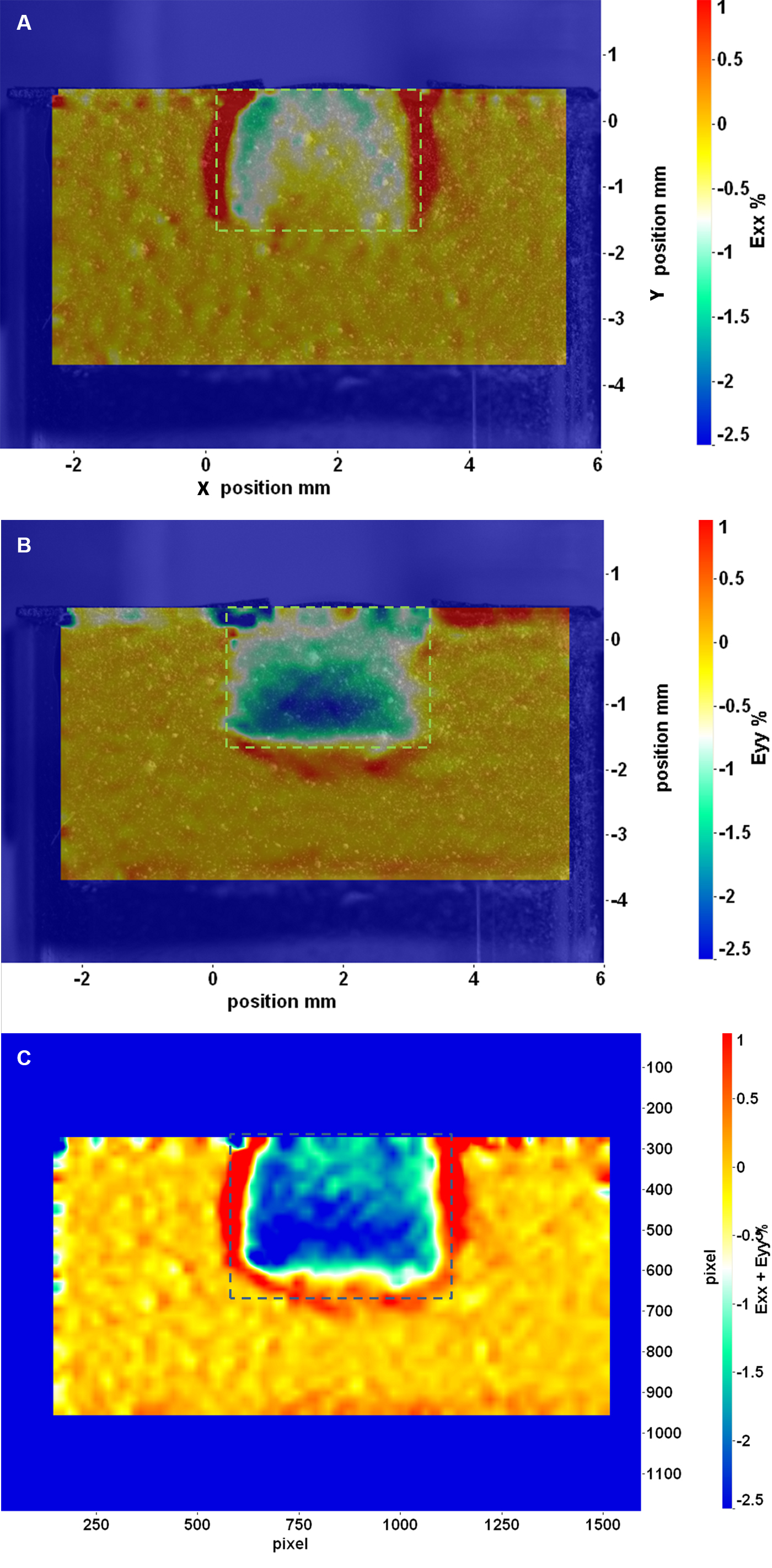Shrinkage of Dental Composite in Simulated Cavity Measured with Digital