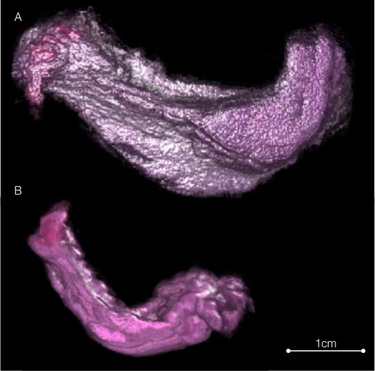ghiandola acinosa prostata
