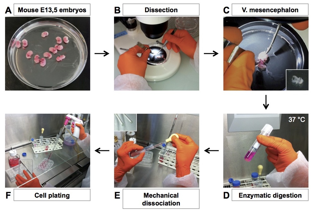 Primary Culture of Mouse Dopaminergic Neurons Protocol