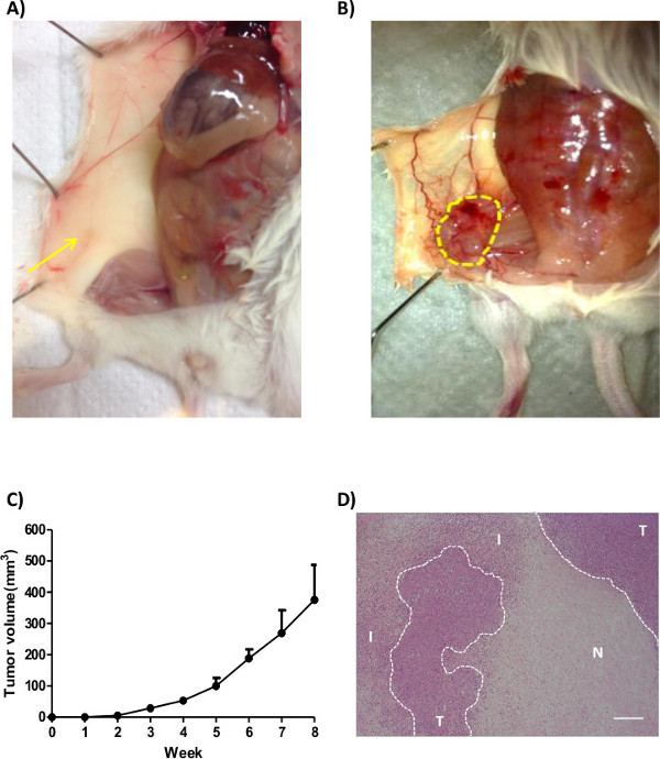 Inguinal fat pad