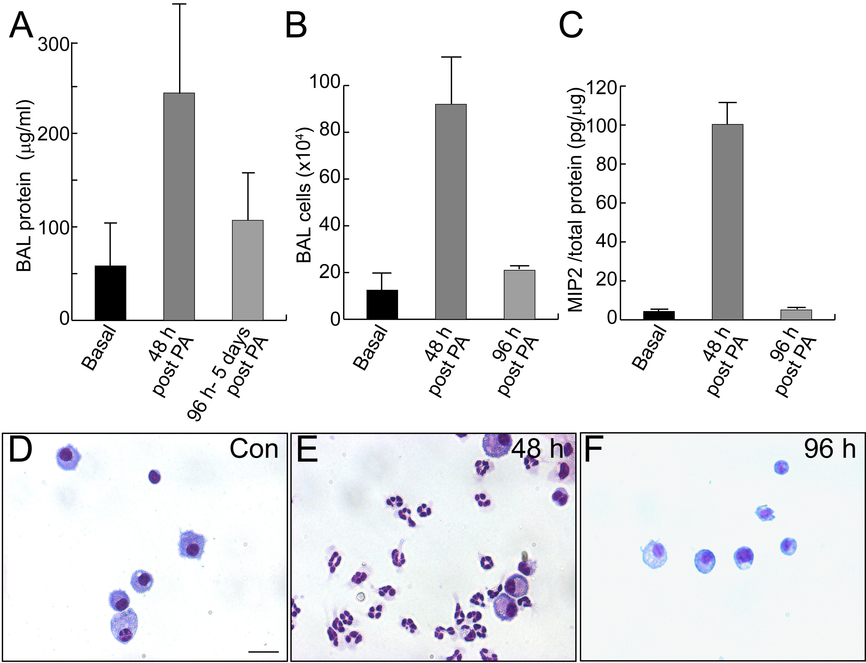 Pseudomonas Aeruginosa Induced Lung Injury Model Protocol