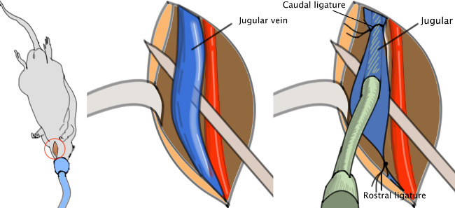 Externo coágulo jugular