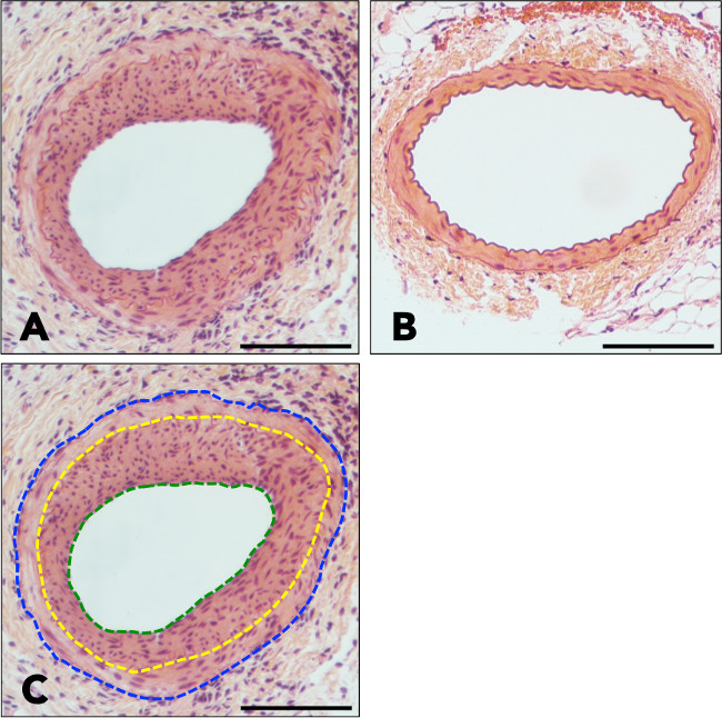 clinica della vena del filo clinica della vena del filo