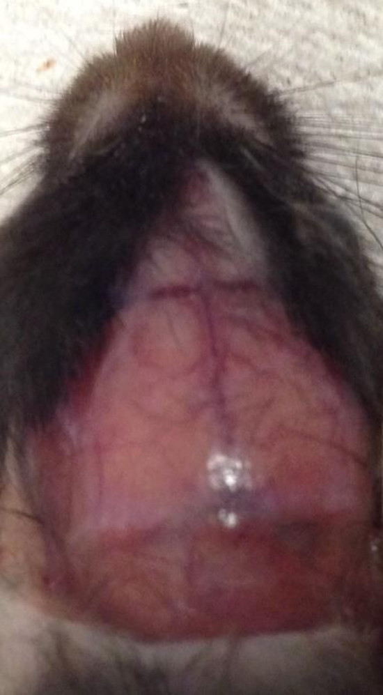 Inyecciones subcutaneous para bajar de peso