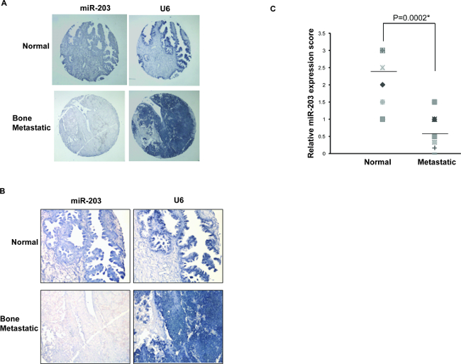 pca analisi prostata