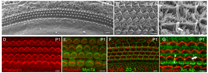 Evaluation Of Planar Cell Polarity Phenotypes In Ciliopathy - 