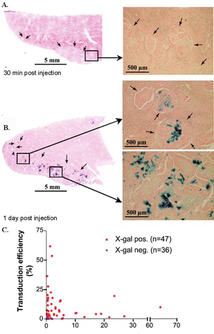 Hepatocarcinoma y perdida de peso