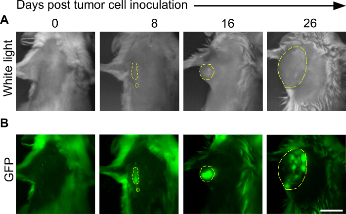 Studying The Role Of Alveolar Macrophages In Breast Cancer