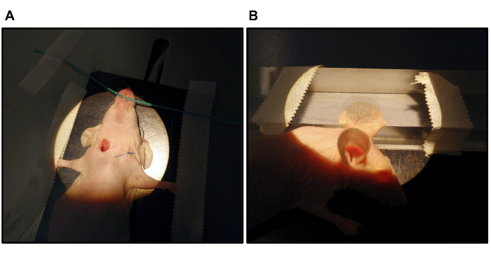 Laser das da das pernas transcutâneo veias tratamento a anatomia