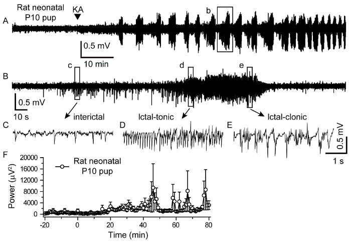 absence seizure eeg rat