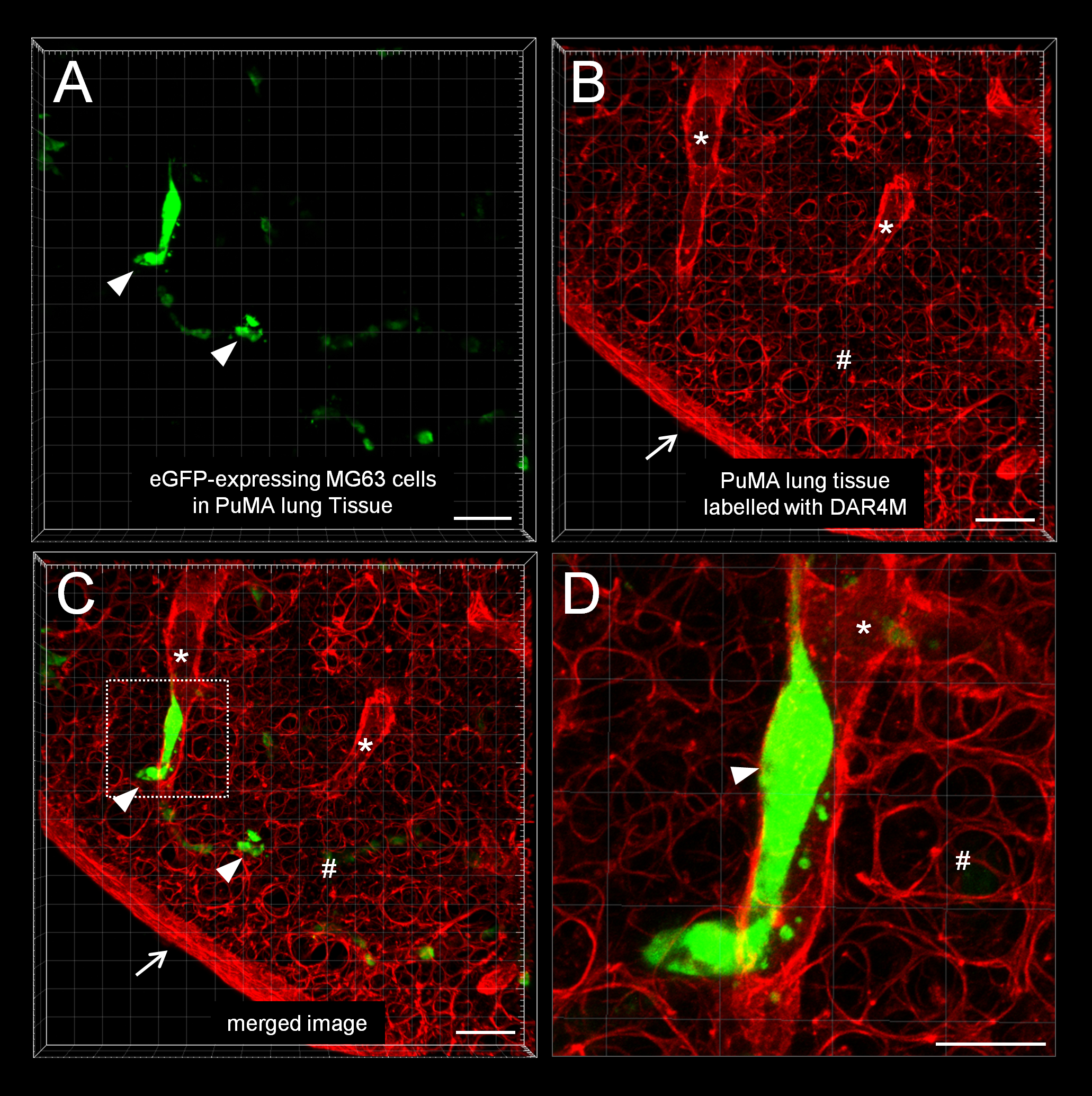 Practical Considerations In Studying Metastatic Lung Colonization In