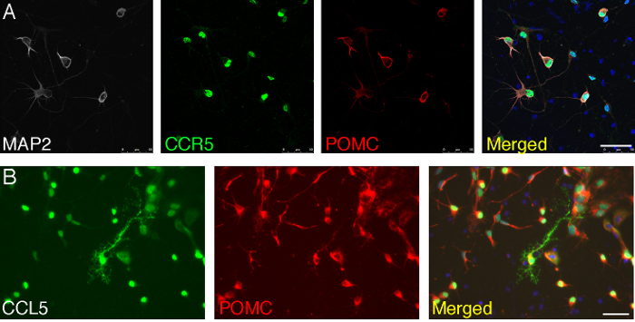 live images of glut4 protein trafficking in mouse primary deconvolution microscopy
