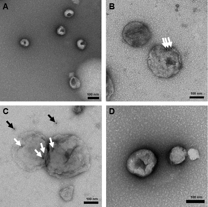 Sample Preparation and Imaging of Exosomes by Transmission Electron