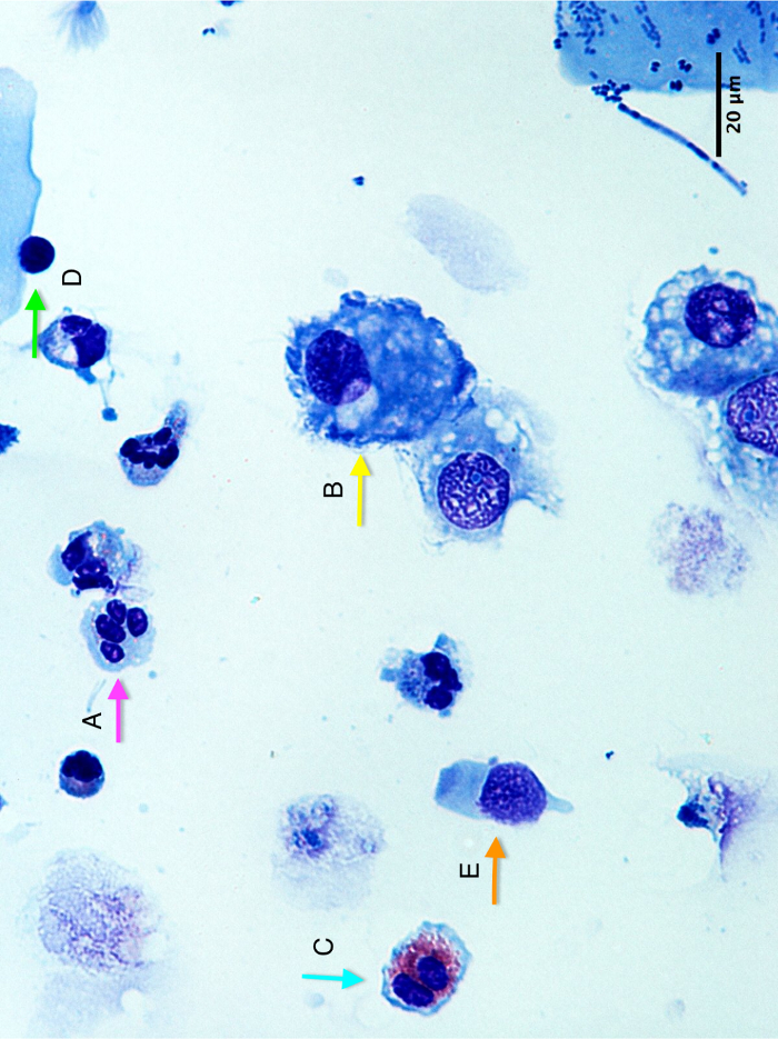Methodology for Sputum Induction and Laboratory Processing Protocol