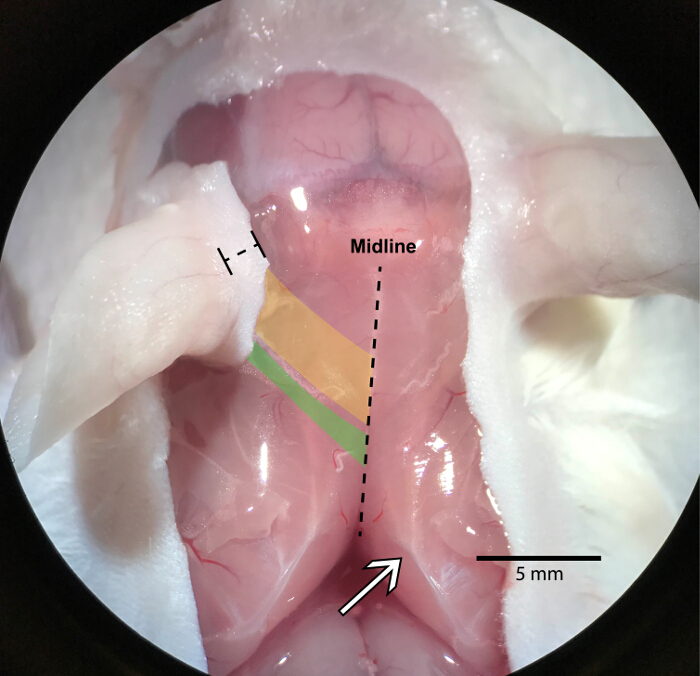 Levator Auris Longus Preparation For Examination Of - 