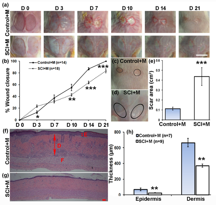Mouse Model of Pressure Ulcers After Spinal Cord Injury Protocol