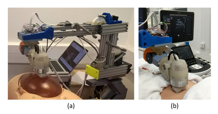 operare la prostata con il robot series operare la prostata con il robot series