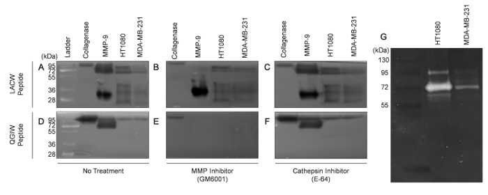 Zymography Protocol