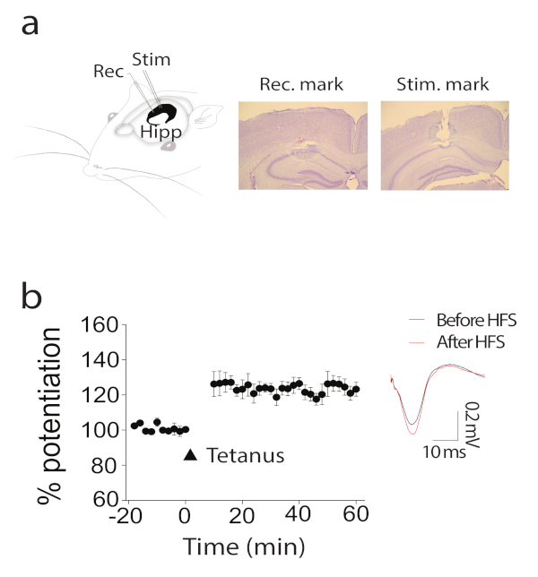 Investigating Longterm Synaptic Plasticity in Interlamellar