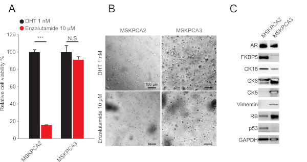 biopsia prostata mirata o a campione biopsia prostata mirata o a campione