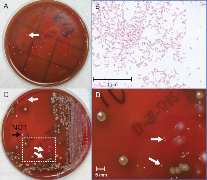 Campylobacter Stool Culture - Stools Item