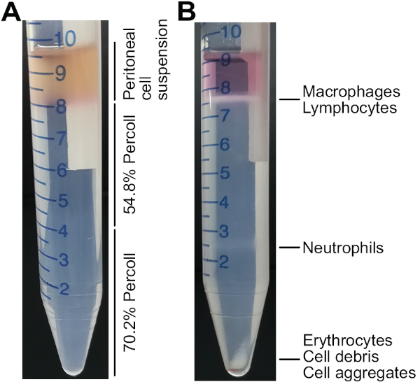 Detecting Migration and Infiltration of Neutrophils in Mice Protocol