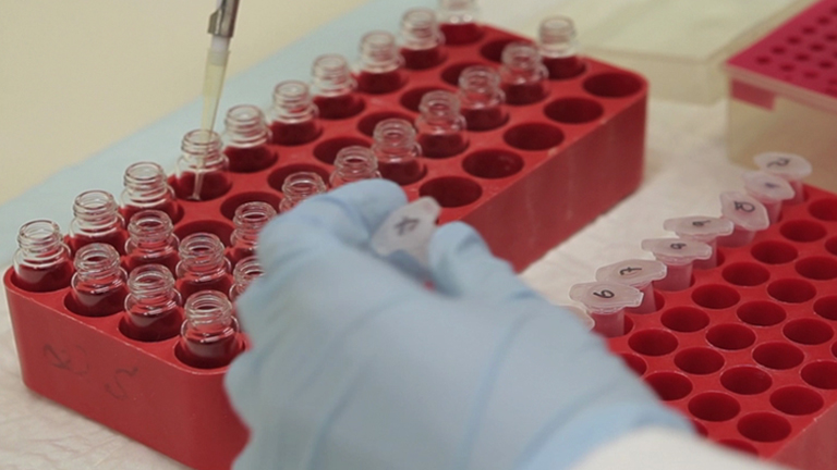 Cholesterol Efflux Assay