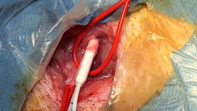 Increasing Pulmonary Artery Pulsatile Flow Improves Hypoxic Pulmonary Hypertension in Piglets