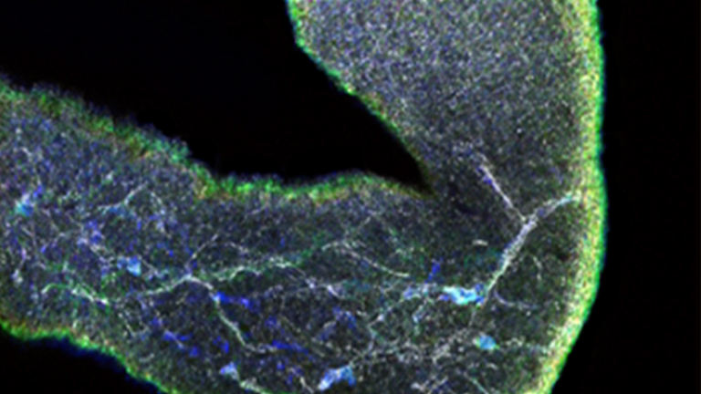 Immunostaining to Visualize Murine Enteric Nervous System Development