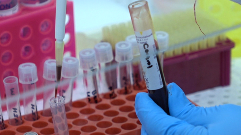 A Simple Flow Cytometric Method to Measure Glucose Uptake and Glucose Transporter Expression for Monocyte Subpopulations in Whole Blood